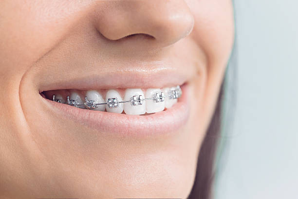 Best Invisalign and Clear Aligners  in White Horse, NJ